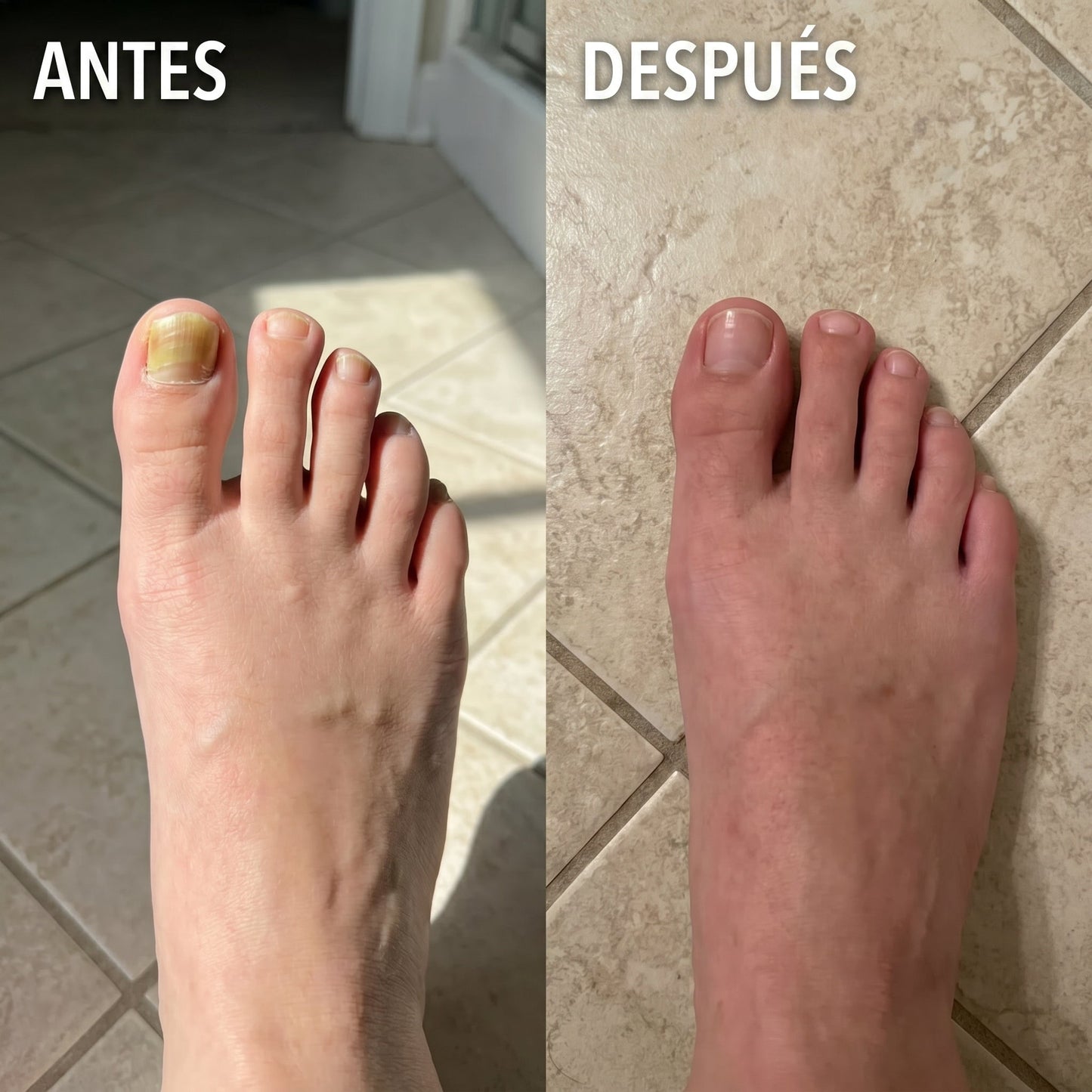Lápiz para el Cuidado y Restauración de Uñas by ORELVIE™