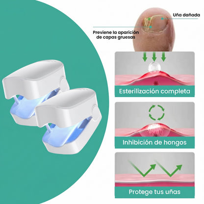 OrthoNails: Reparador Antifúngico Laser by Orelvie